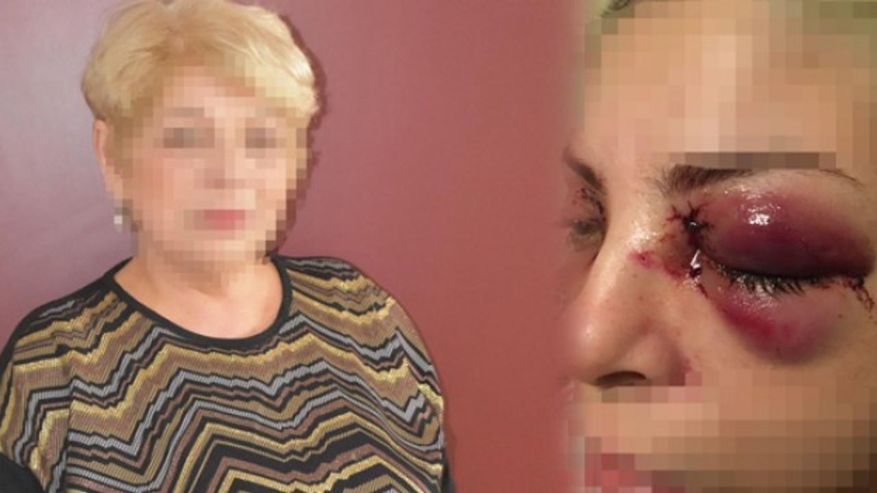 Adana'da başka bir hastanın gözlerini oyan şizofren Manisa'da da aynı saldırıyı gerçekleştirmiş