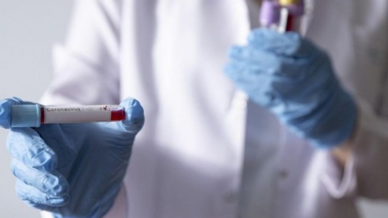 Koronavirüs verileri açıklandı: 124 can kaybı, 7 bin 718 yeni vaka
