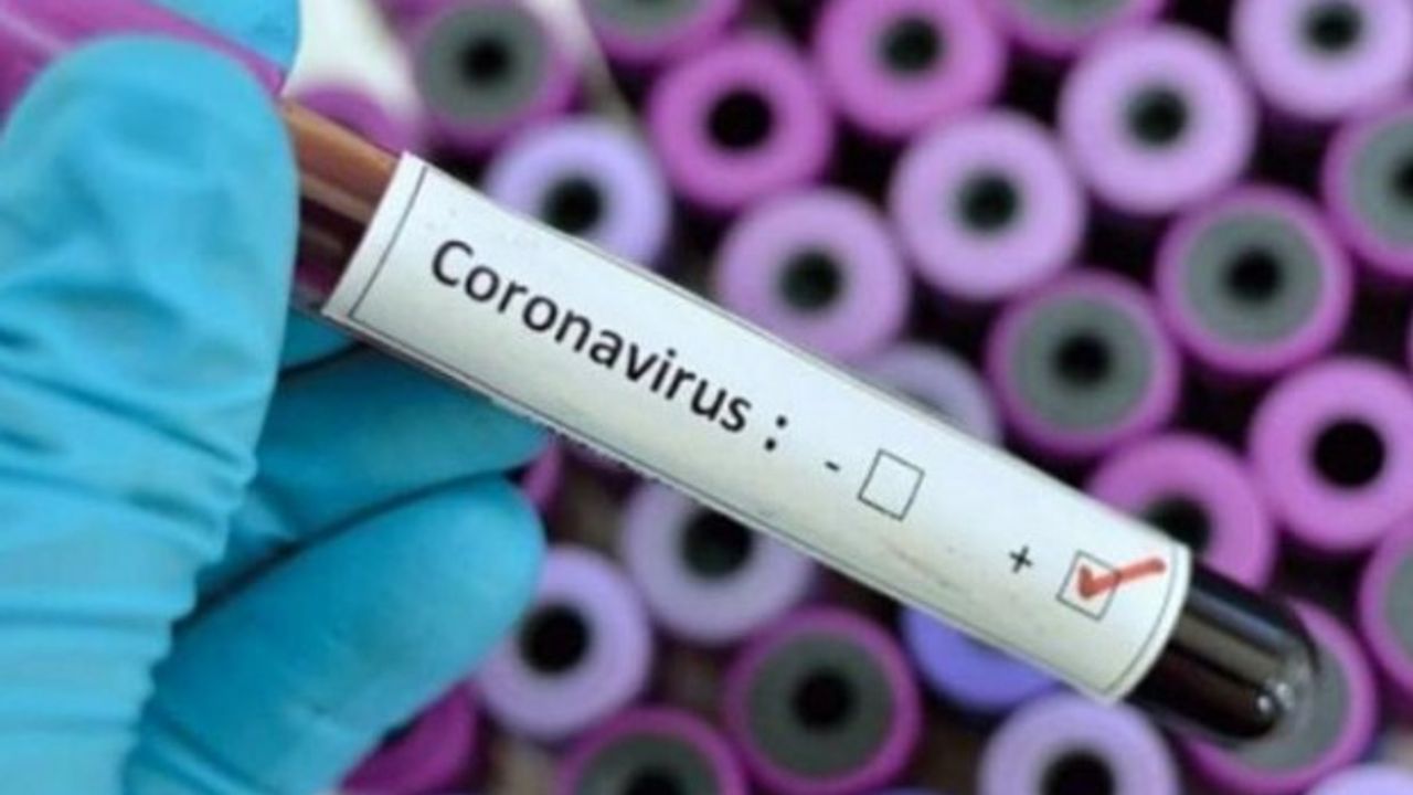 Koronavirüs tablosu açıklandı… 229 vefat, 25 bin 528 yeni vaka