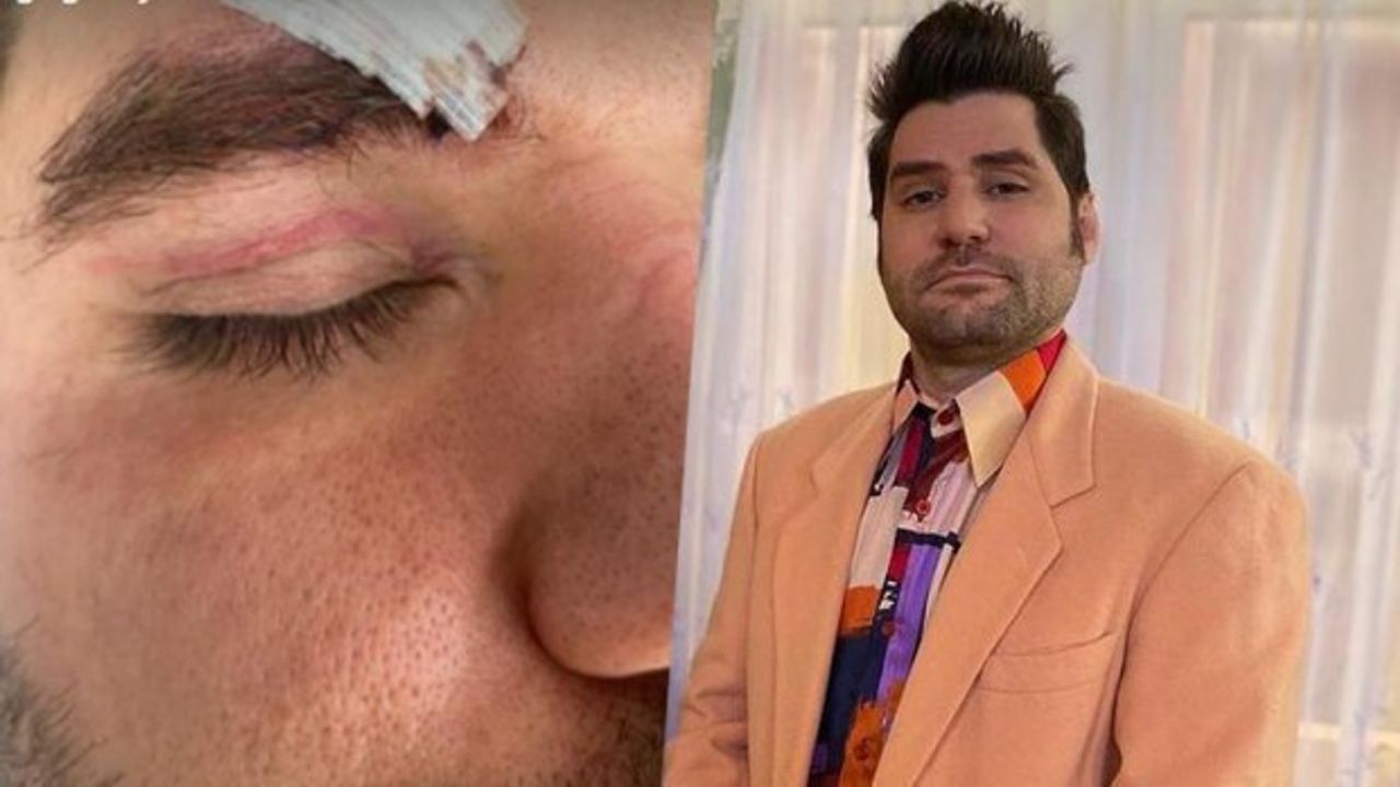 Ünlü oyuncu Ceyhun Fersoy saldırıya uğradı