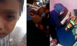 Dehşete düşüren görüntüler! Çocuklarına işkence yapan anne- baba tutuklandı
