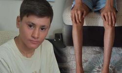 'Balık pulu' hastası Kayra, gündüzleri evden çıkamıyor