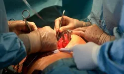 Ameliyatta karında unutulan cerrahi alet 18 ay sonra çıkarıldı