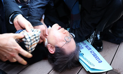 Ana muhalefet partisi lideri bıçaklandı