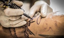 Son 5 yılda 1 milyondan fazla dövme sildirme işlemi uygulandı