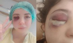 Sokakta taciz ve darp: 'Yüzümün yarısını hissetmiyorum'