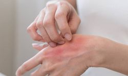 Kimyasallar alerjiye davetiye çıkarıyor