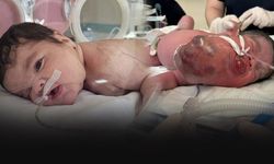 34 haftalık minik Eymen dünyada yedinci vaka! Boynundan 445 gram tümör çıkarıldı