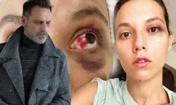 Ozan Güven'e hapis cezası