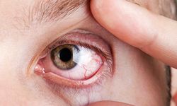Retinadaki damar tıkanıklıklarına dikkat: Görme kaybına sebep olabilir!