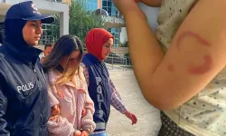 Kreşte akılalmaz olay: Çocuğu ısıran bakıcı için karar verildi