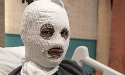 Elindeki gaz tüpü bomba gibi patladı!