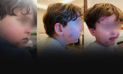 Kreşte darp skandalı