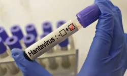 Grip ile karıştırılıyor: Uzmanlardan 'hantavirüs' açıklaması