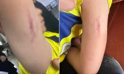 10 yaşındaki çocuk tartıştığı çocuğun annesi tarafından darbedildi!