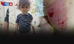 Kızgın tereyağı minik Mercan'ın üzerine dökülmüştü... İşte panik anları!
