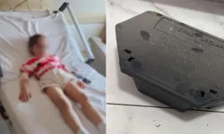 Kreşte akılalmaz ihmal iddiası: Çocuk hastanelik oldu