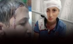 Yüzünde 12 santimlik iz bıraktı: Milyonluk tazminat kararı!
