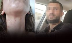 'Bu gece burada katliam yapacağım' demiş: Eşine işkence eden sanığa 11,5 yıl hapis istemi!