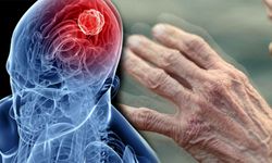 Parkinson hastalığına yapay zeka desteği!