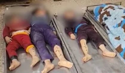 Gazze'de insanlık dramı... Çocukların bacaklarındaki korkunç detay!