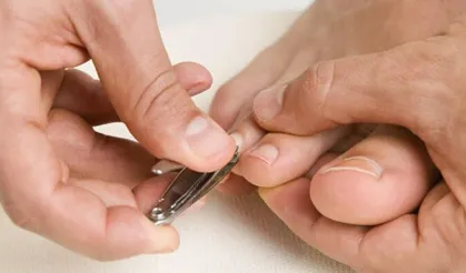 Diyabet hastaları dikkat: Yanlış tırnak kesimi...