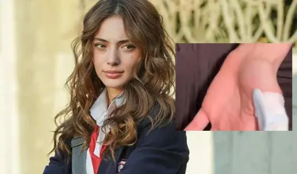 TRT dizisi setinde korkunç kaza: Parmağı kopuyordu!