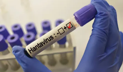 Grip ile karıştırılıyor: Uzmanlardan 'hantavirüs' açıklaması