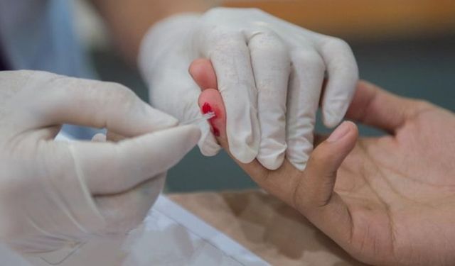 Dünyada düştü Türkiye'de arttı: HIV vakaları kadınlarda fırladı