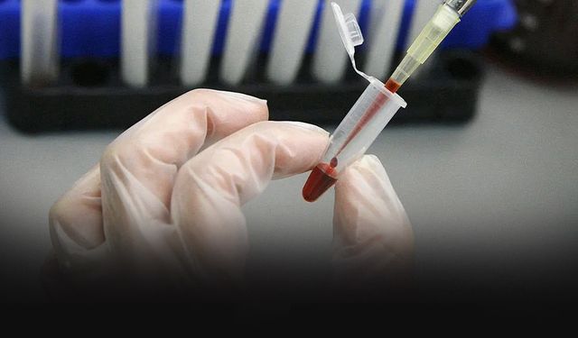 İzmir İl Sağlık Müdürlüğünden HIV açıklaması... "İstismar bulgusuna rastlanmamıştır"