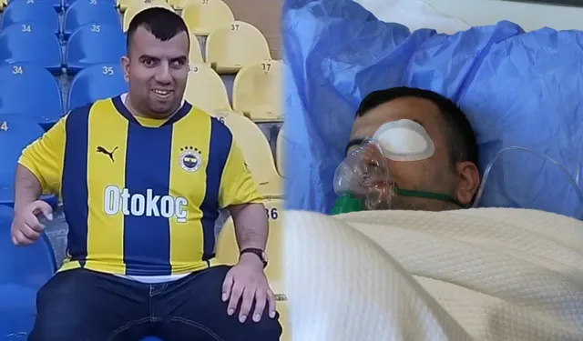 ‘Kadıköy Boğası’ göz ameliyatı oldu