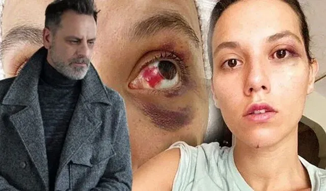 Ozan Güven'e hapis cezası