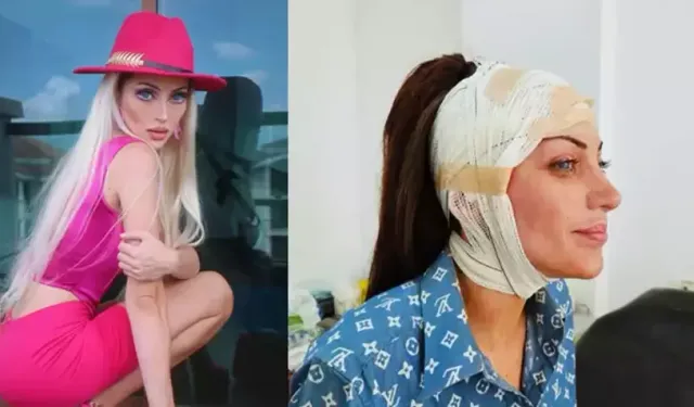 Barbie'ye benzemek için 27 kez ameliyat olmuştu: Fenomenin gizemli ölümü!