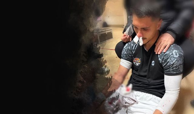 İzmir takımına çirkin saldırı: Burnu 3 yerinden kırıldı!