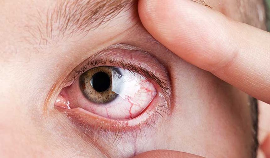 Retinadaki damar tıkanıklıklarına dikkat: Görme kaybına sebep olabilir!