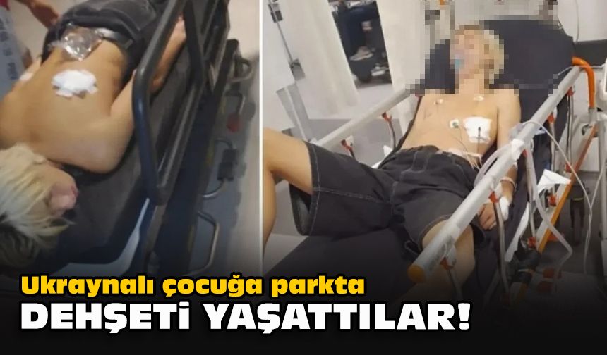 Ukraynalı çocuğa parkta dehşeti yaşattılar!