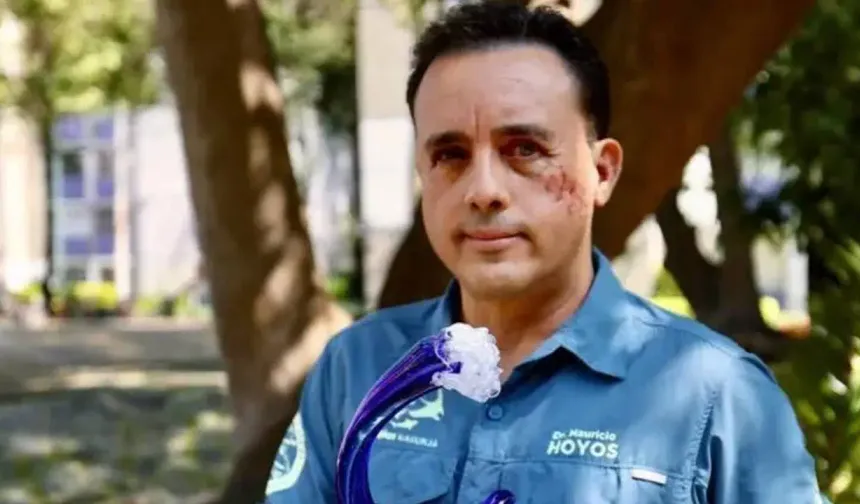 Köpekbalığı başından ısırdı, sağ kaldı: 'Hayatımı bağışladı'