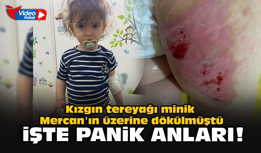 Kızgın tereyağı minik Mercan'ın üzerine dökülmüştü... İşte panik anları!