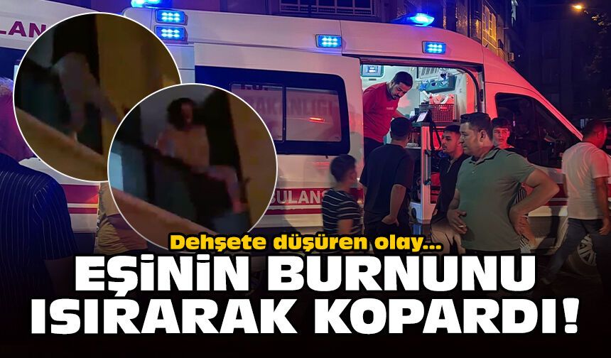 Dehşete düşüren olay: Eşinin burnunu ısırarak kopardı!
