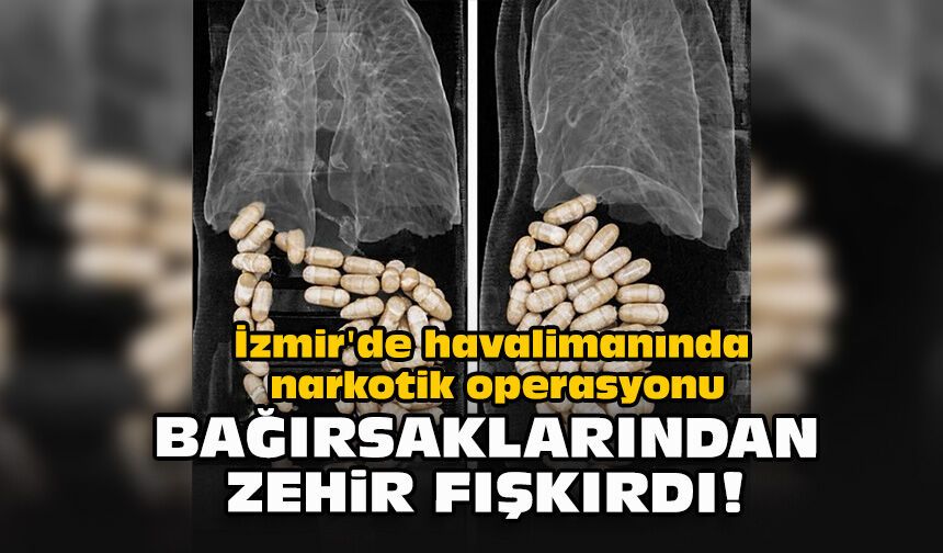 İzmir'de havalimanında narkotik operasyonu: Bağırsaklarından zehir fışkırdı!