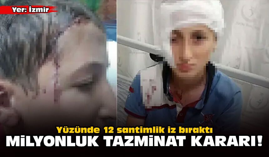 Yüzünde 12 santimlik iz bıraktı: Milyonluk tazminat kararı!