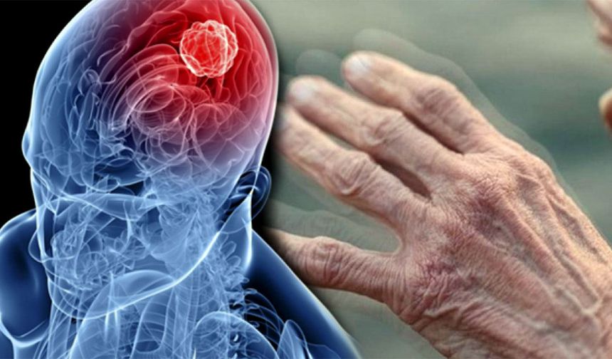 Parkinson hastalığına yapay zeka desteği!
