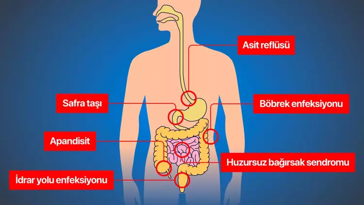 Karın ağrınızın yeri ne anlama geliyor?