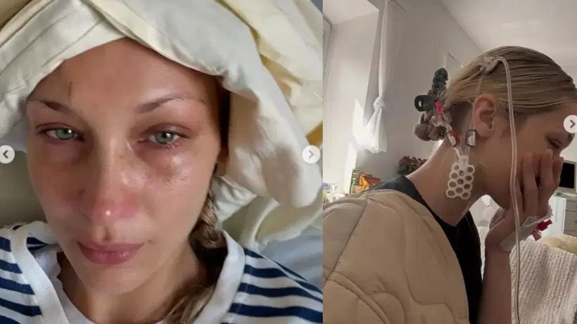 Bella Hadid Lyme Hastaligiyla Mucadele Ediyor 1