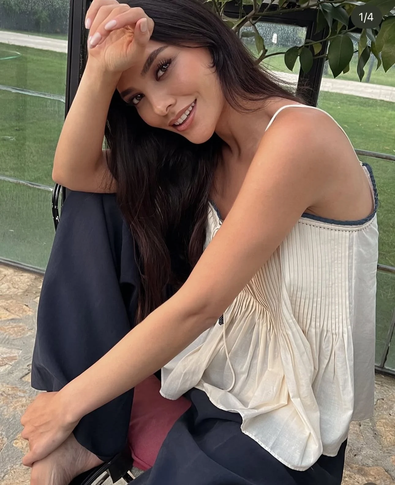 Ne Botoks Ne Dolgu Var Demisti Estetiksiz Hali Ortaya Cikti 1