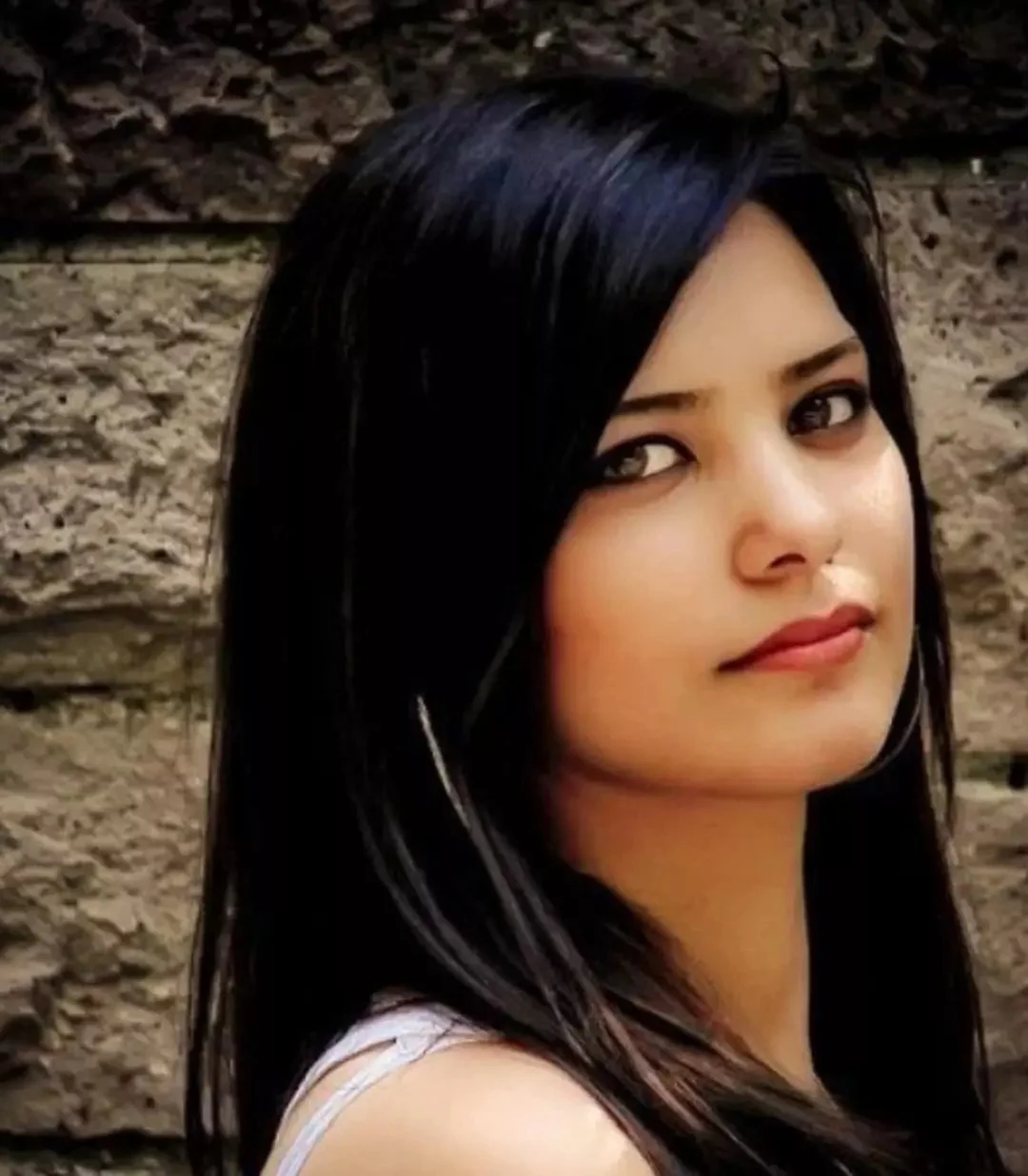 Ne Botoks Ne Dolgu Var Demisti Estetiksiz Hali Ortaya Cikti 2