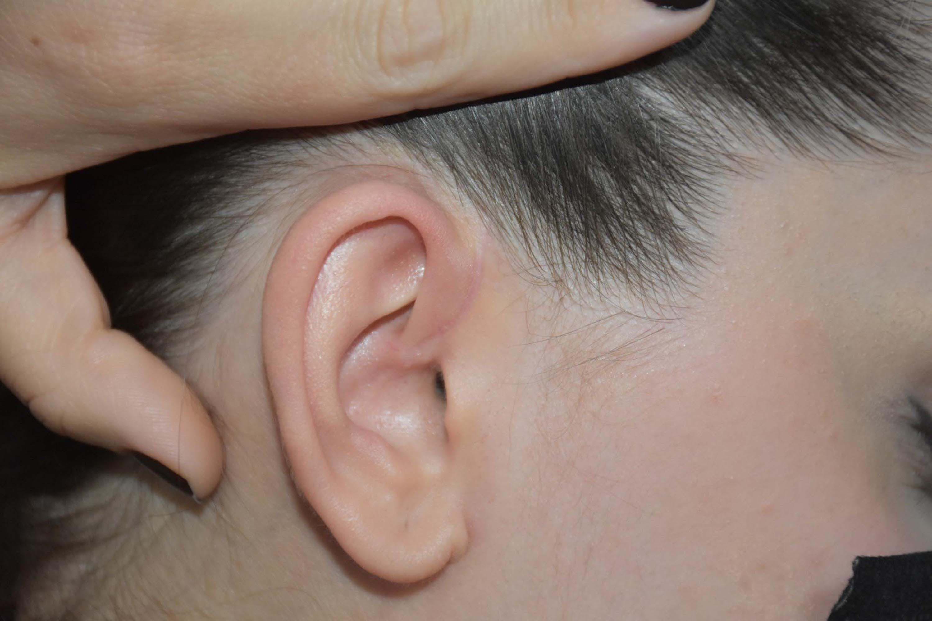 B E T U L U B O Y N U N D A N Y A R A L A Y A N K O M S U O G L U N A 973180 289001