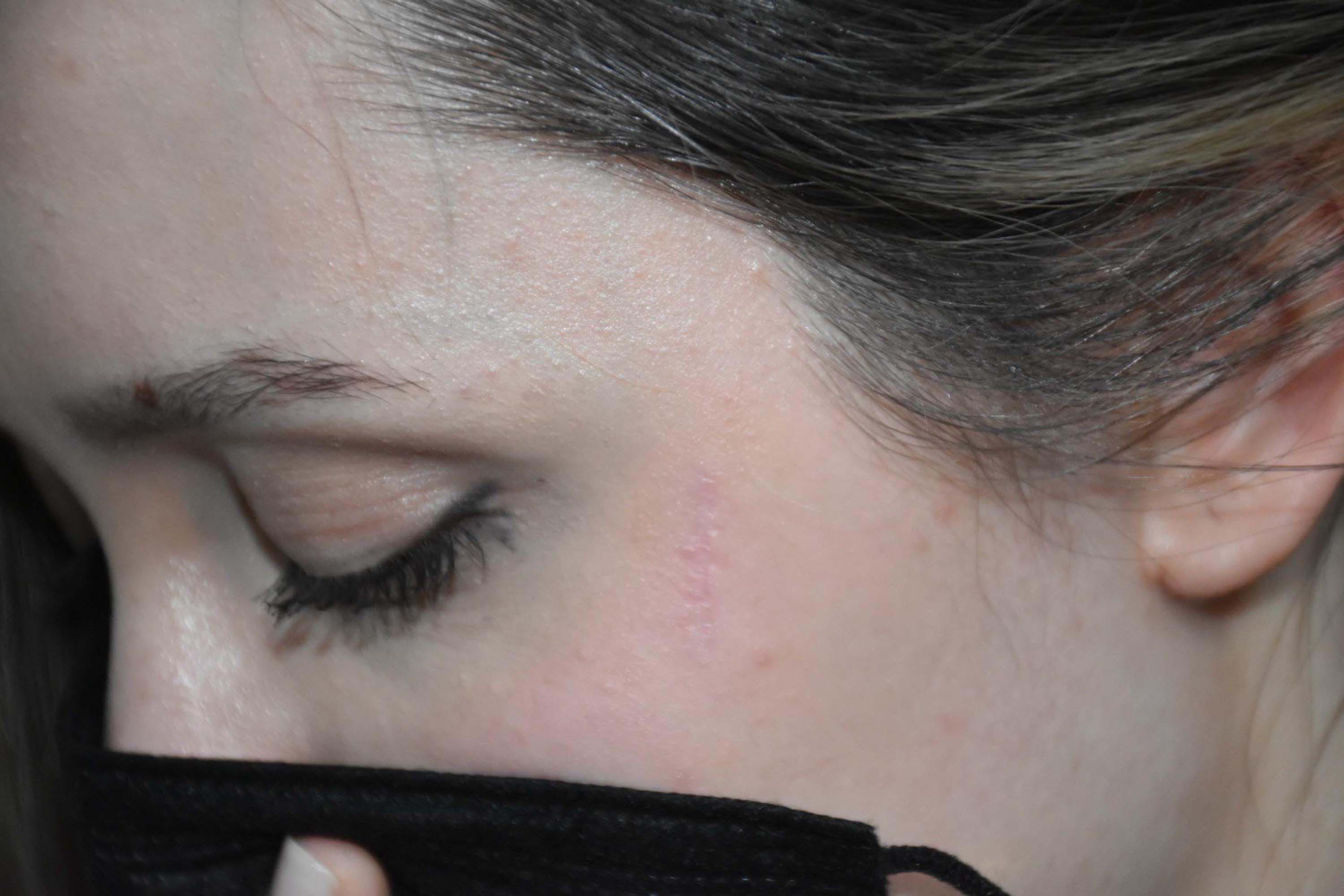 B E T U L U B O Y N U N D A N Y A R A L A Y A N K O M S U O G L U N A 973183 289001