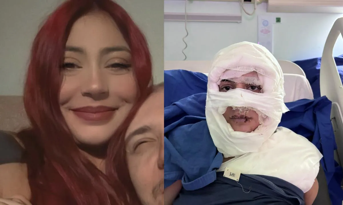 Sevgilimle Mi Birliktesin Deyip Kadini Yakti Iste Kan Donduran Goruntuler 1