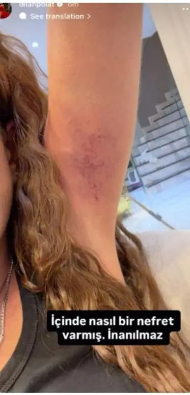 B2546C6C 9033 4287 84Be 5B22B301D934